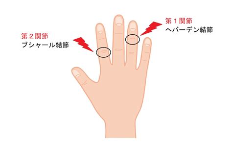 手指第一節|「指の第一関節が痛い」原因とは？何科を受診するべきかも併せ。